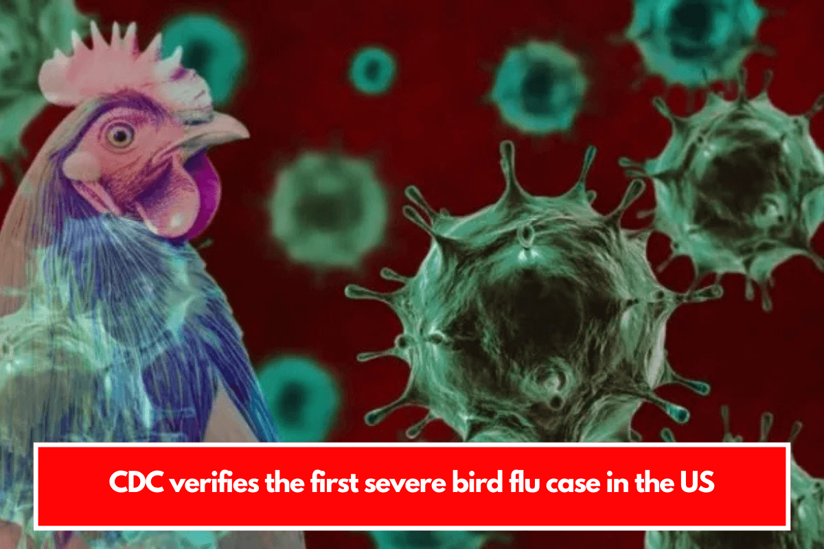 CDC verifies the first severe bird flu case in the US